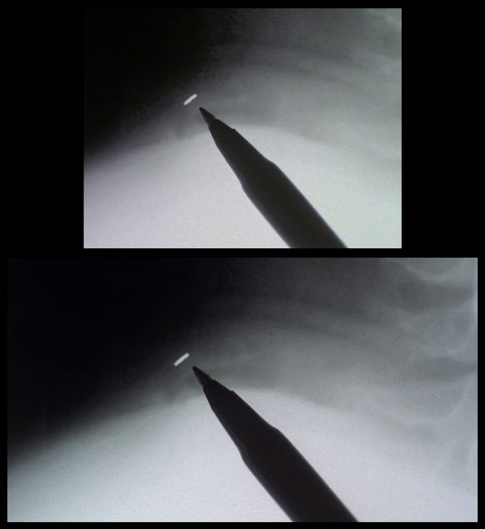 X-Files Blu-ray DVD Comparison 301 3X01 The Blessing Way Screencap